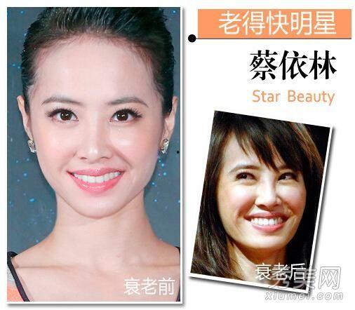 明星老得快,明星为何老得快，背后的惊人真相